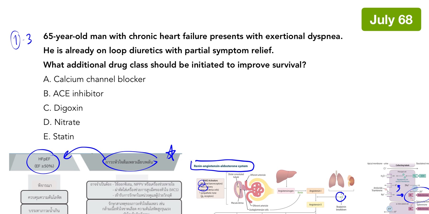 Read more about the article Heart failure: ยาที่เพิ่มอัตราการรอดชีวิต (แนว NL2 Medicine July 68)
