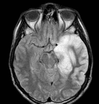Read more about the article เฉลยข้อสอบ Comprehensive exam: Encephalitis