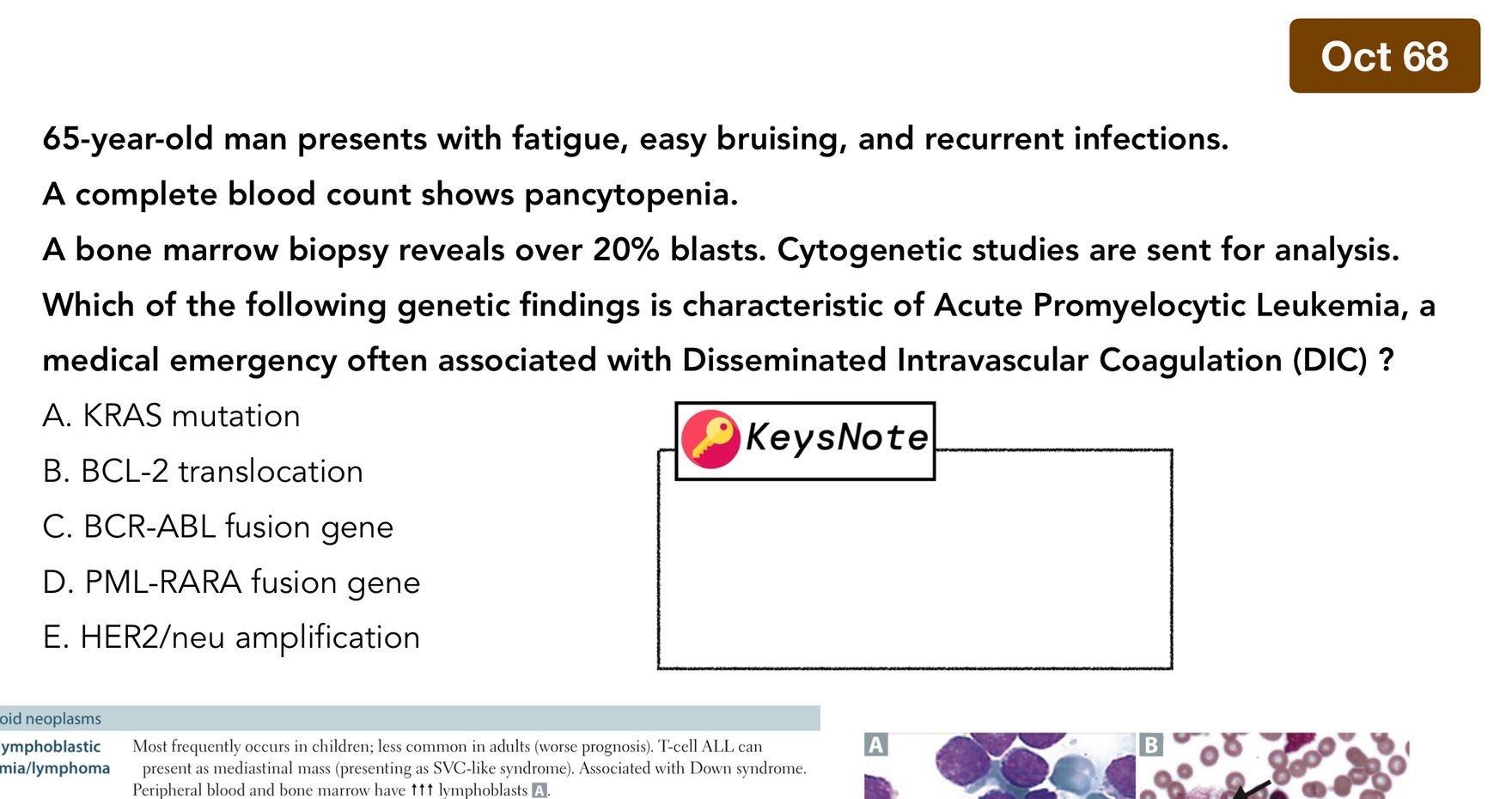 Read more about the article เฉลยข้อสอบ NL : Acute Myeloid Leukemia (AML) — และพันธุกรรมที่ออกสอบบ่อย