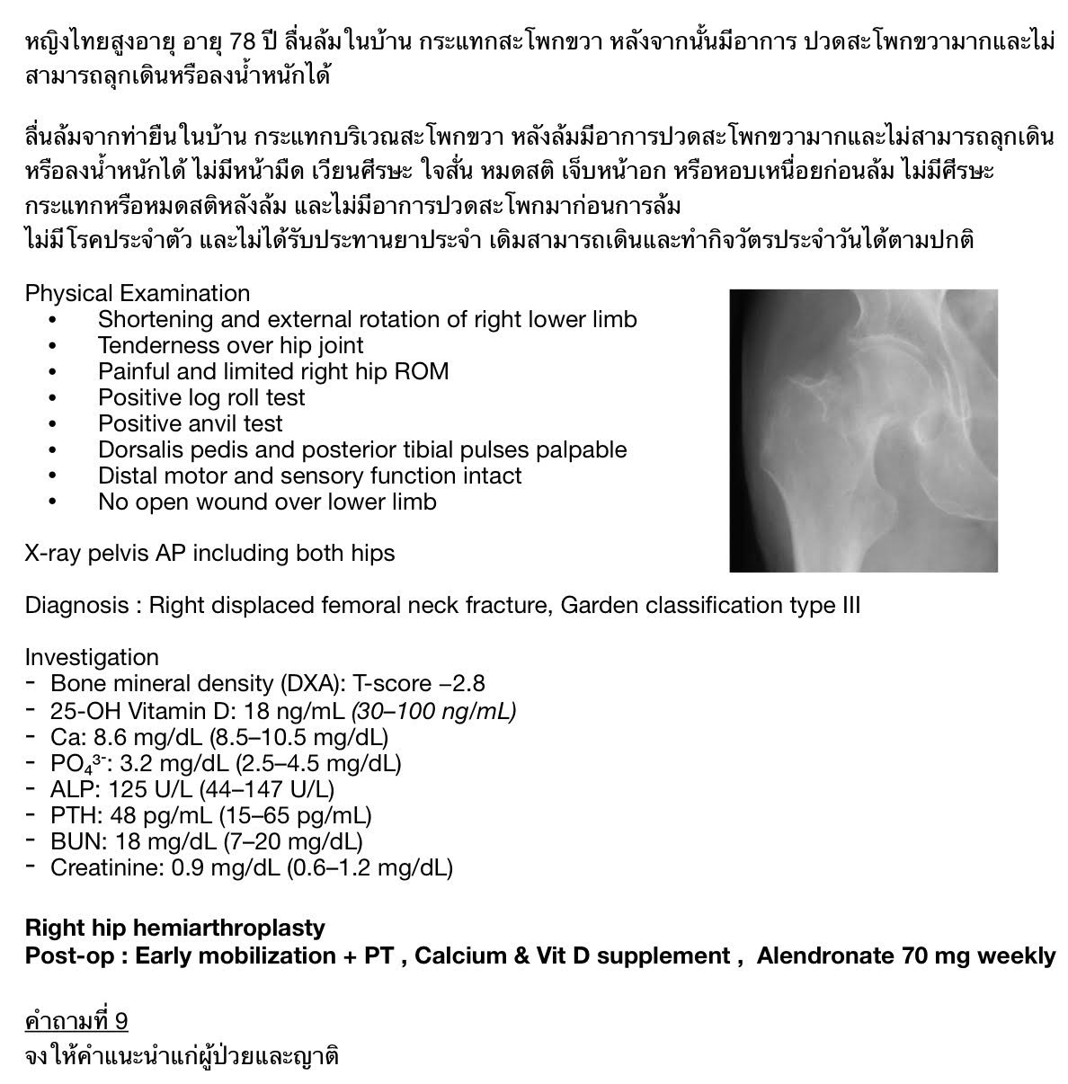 Hip Pain