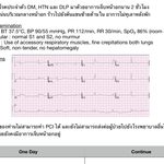 STEMI