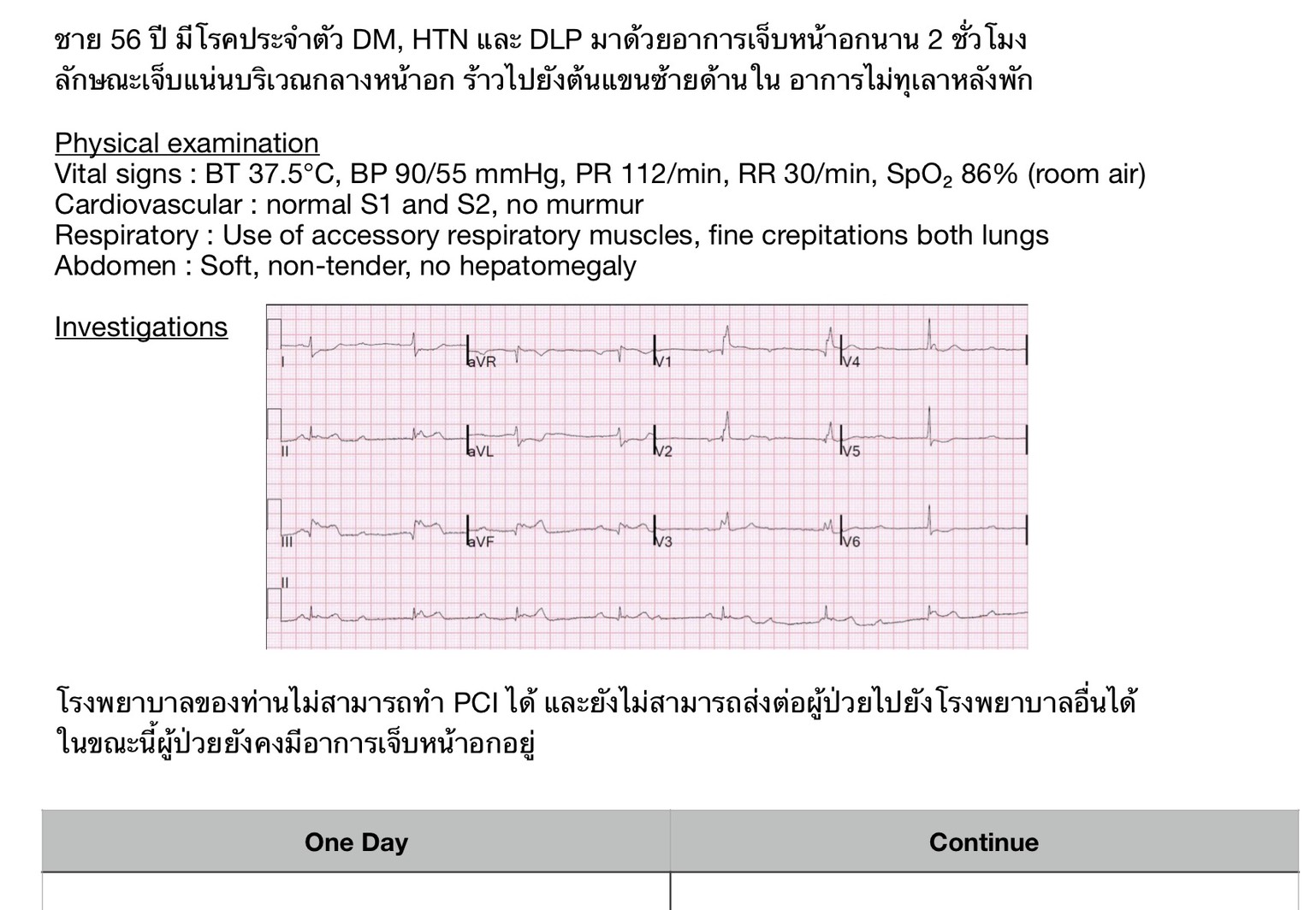 STEMI