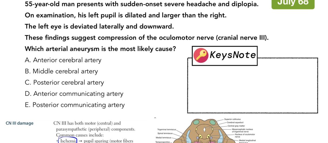 CN III palsy — แนวข้อสอบ NL1 กรกฎาคม 2568