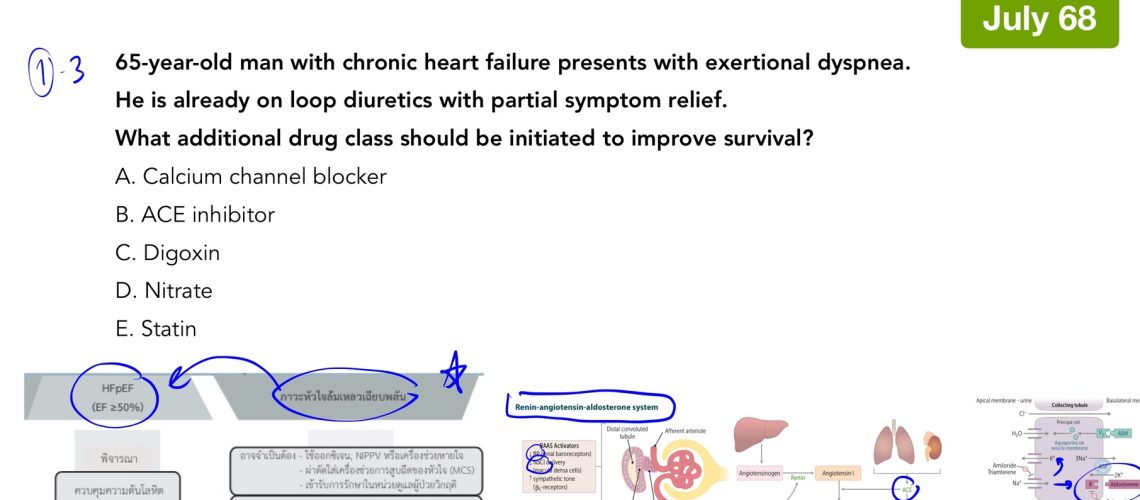 Heart failure