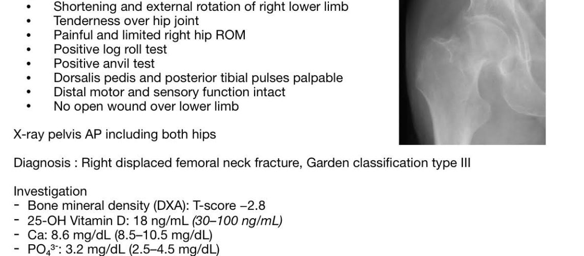 Hip Pain